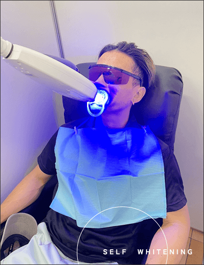 セルフホワイトニング